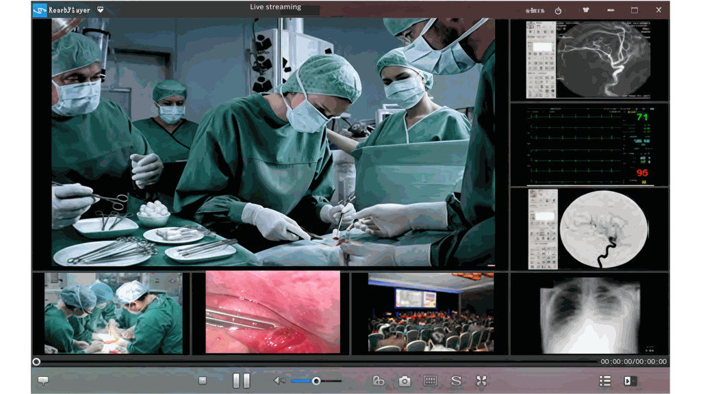 Live surgery streaming and monitoring views